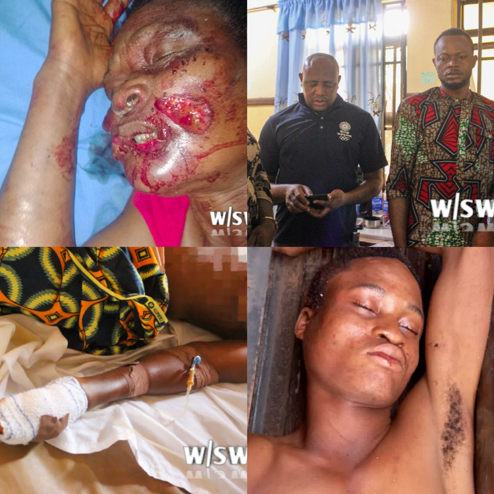 Horror as domestic worker cuts off 72-year-old employer’s genital for money ritual in Anambra (Graphic photos)