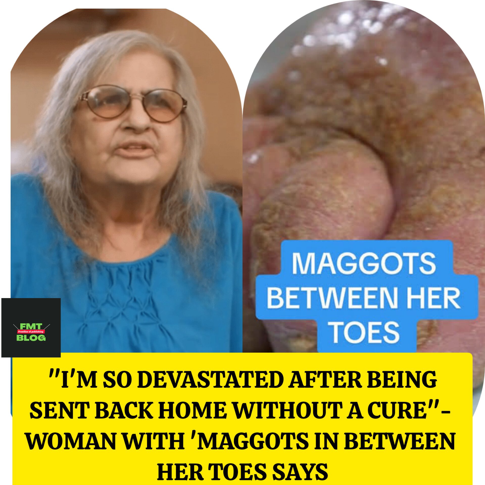 ”I’M SO DEVASTATED AFTER BEING SENT BACK HOME WITHOUT A CURE”- WOMAN WITH MAGGOTS IN BETWEEN HER TOES SAYS (Video)