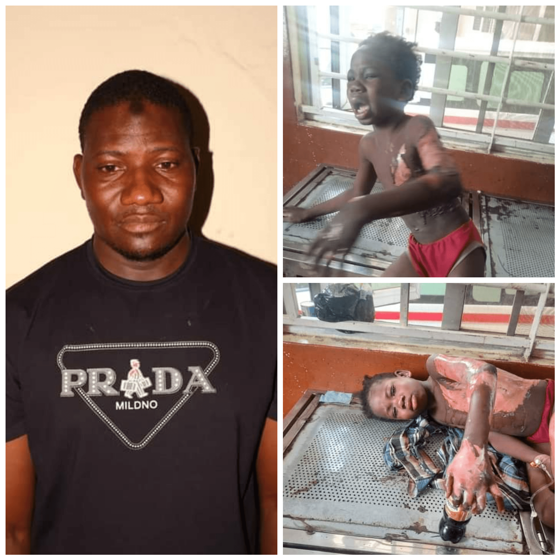 30-year-old-man sets young girl ablaze, Alleges she is a witch sent to kill him(PHOTOS)