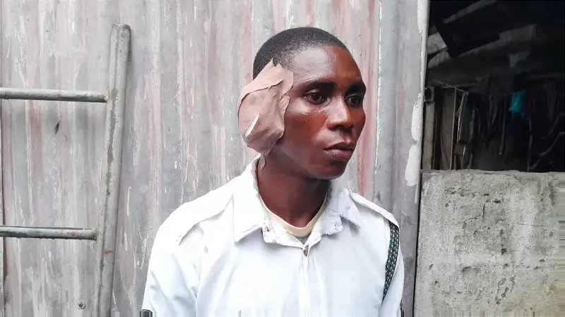 Drama as Driver Bites Off VIO Officer’s Ear in Delta (Photo)