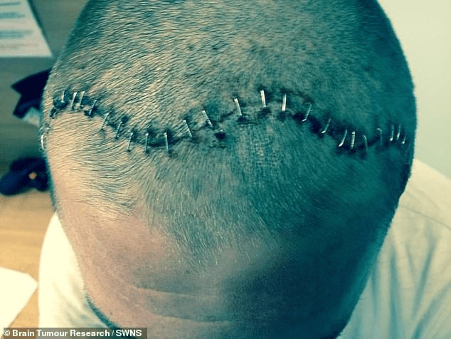 Man Diagnosed with Brain Tumour After Suddenly Became H0rny and Aggressive (PHOTOS)