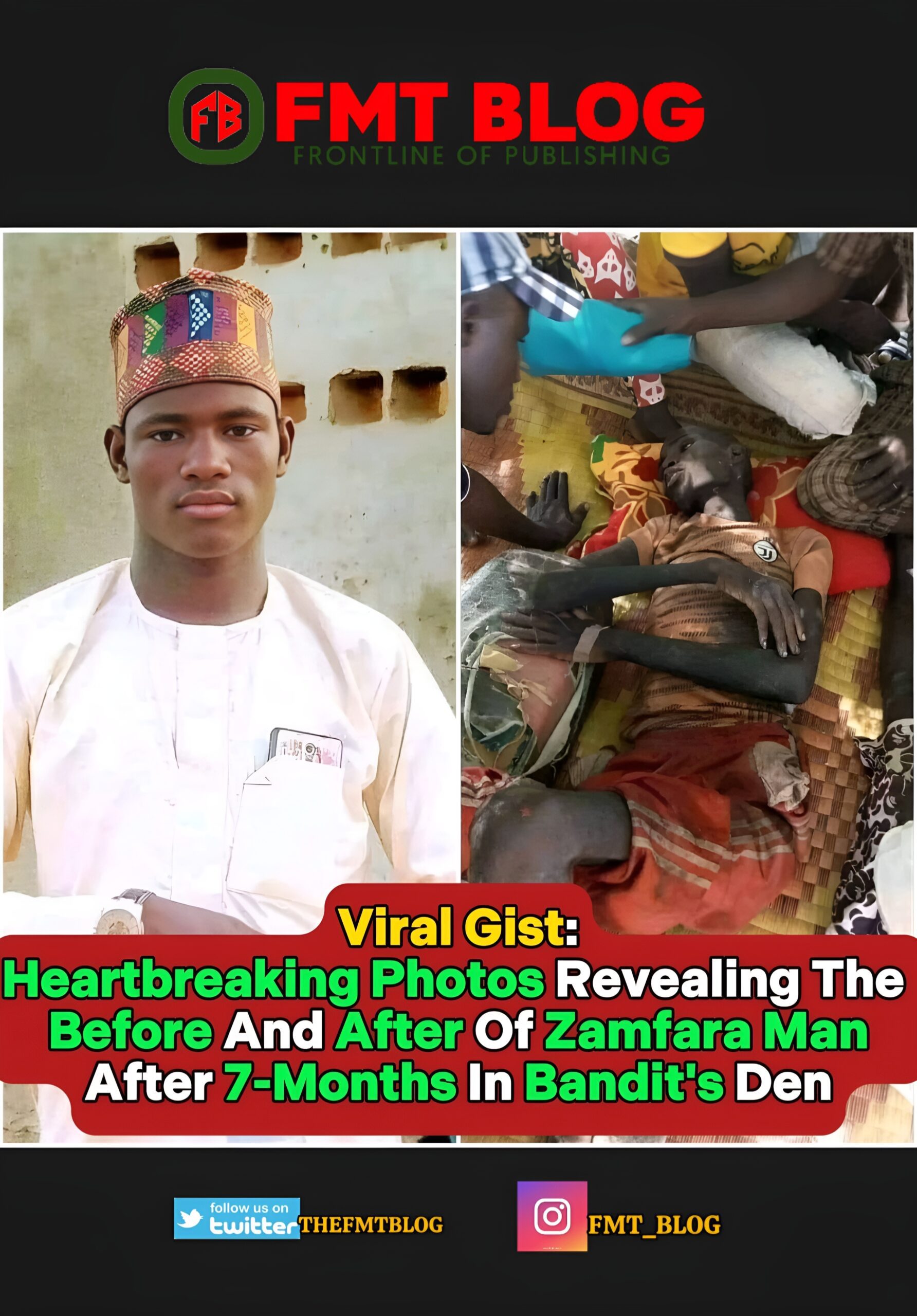 Heartbreaking Photos Revealing The Before And After Of Zamfara Man After 7 Months In Bandit’s Den