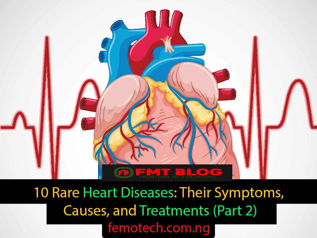 10 Rare Heart Diseases: Their Symptoms, Causes, and Treatments (Part 2)