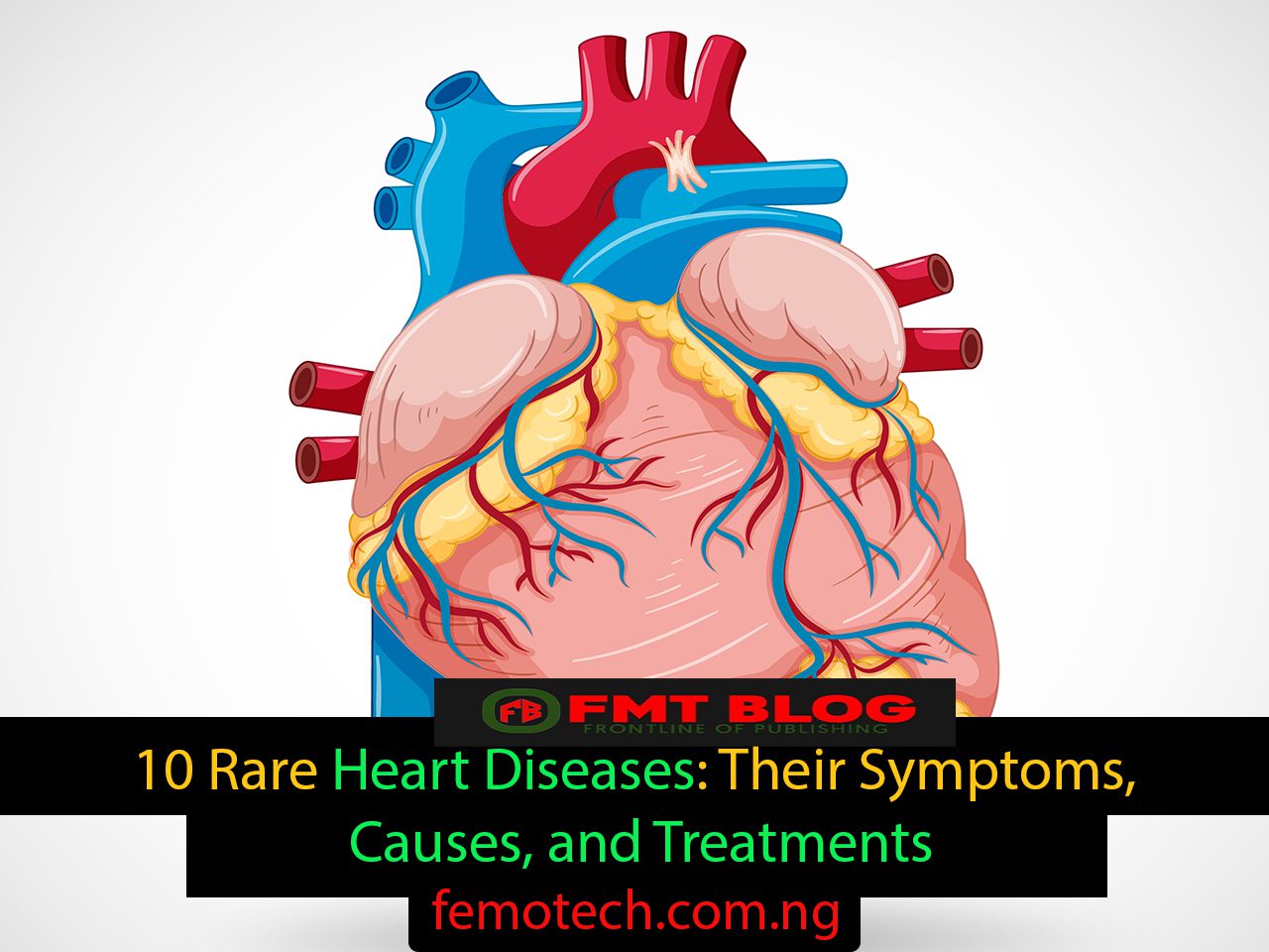 10 Rare Heart Diseases: Their Symptoms, Causes, and Treatments