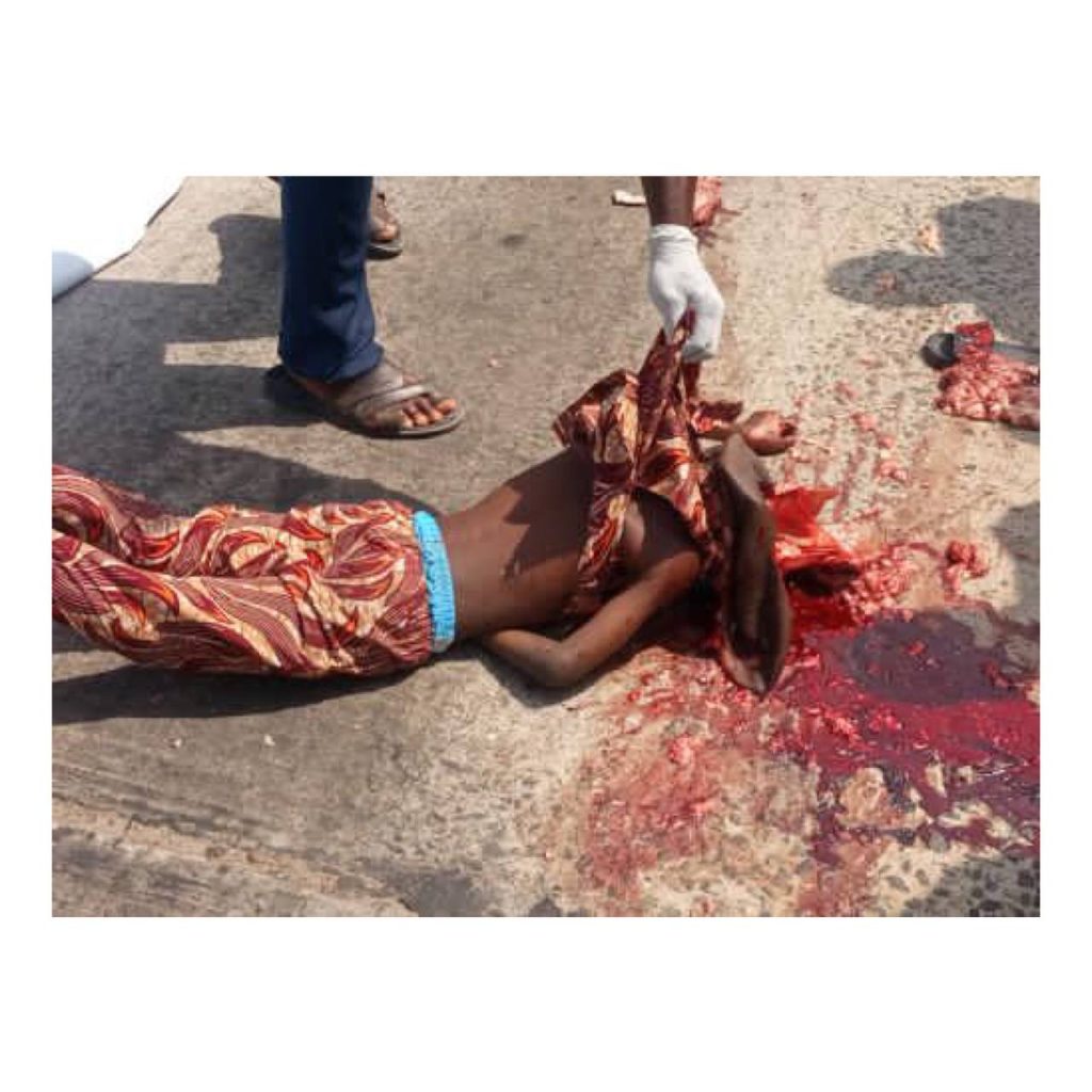 BRT Bus Crushed 5-Year-Old Boy To Death