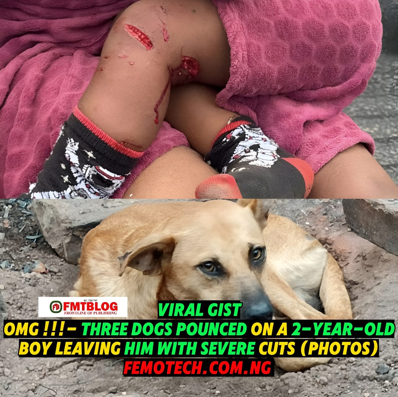OMG!!!- Three Dogs Pounced On A 2-Year-Old Boy Leaving Him With Severe Cuts (PHOTOS)