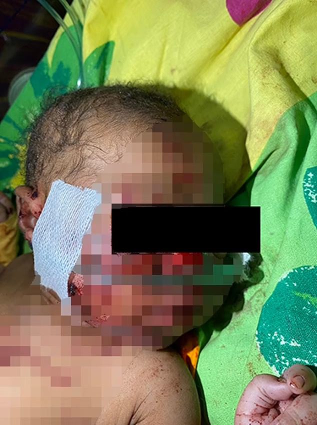 Newborn Baby Remarkably Survived 6-Hours Beneath The Ground