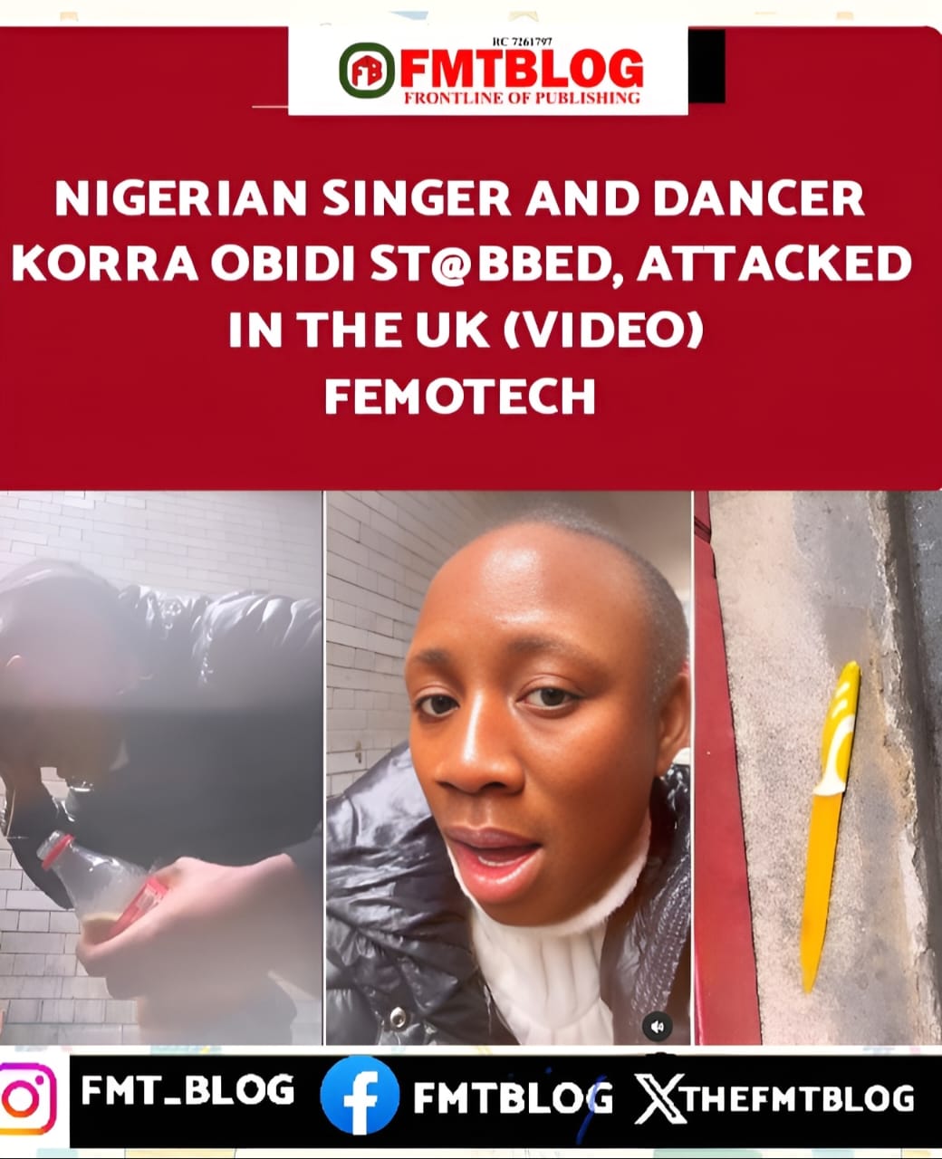 Nigerian Singer And Dancer Korra Obidi St@bbed, Attacked With Acid In The UK(VIDEO)