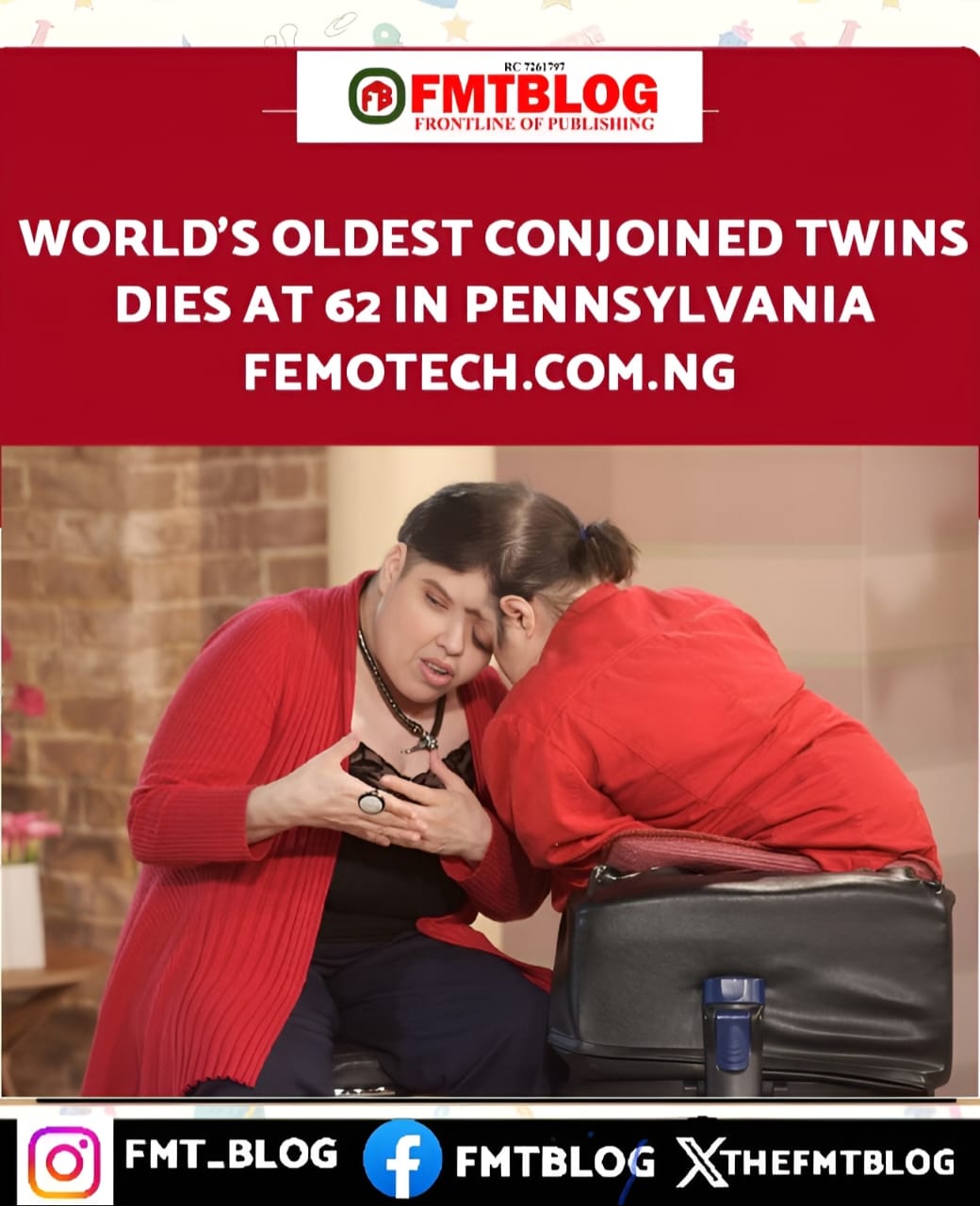 World’s Oldest Conjoined Twins Dies At 62