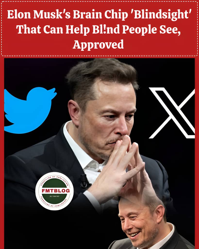 Elon Musk’s Brain Chip ‘Blindsight’ That Can Help Blind People See, Approved