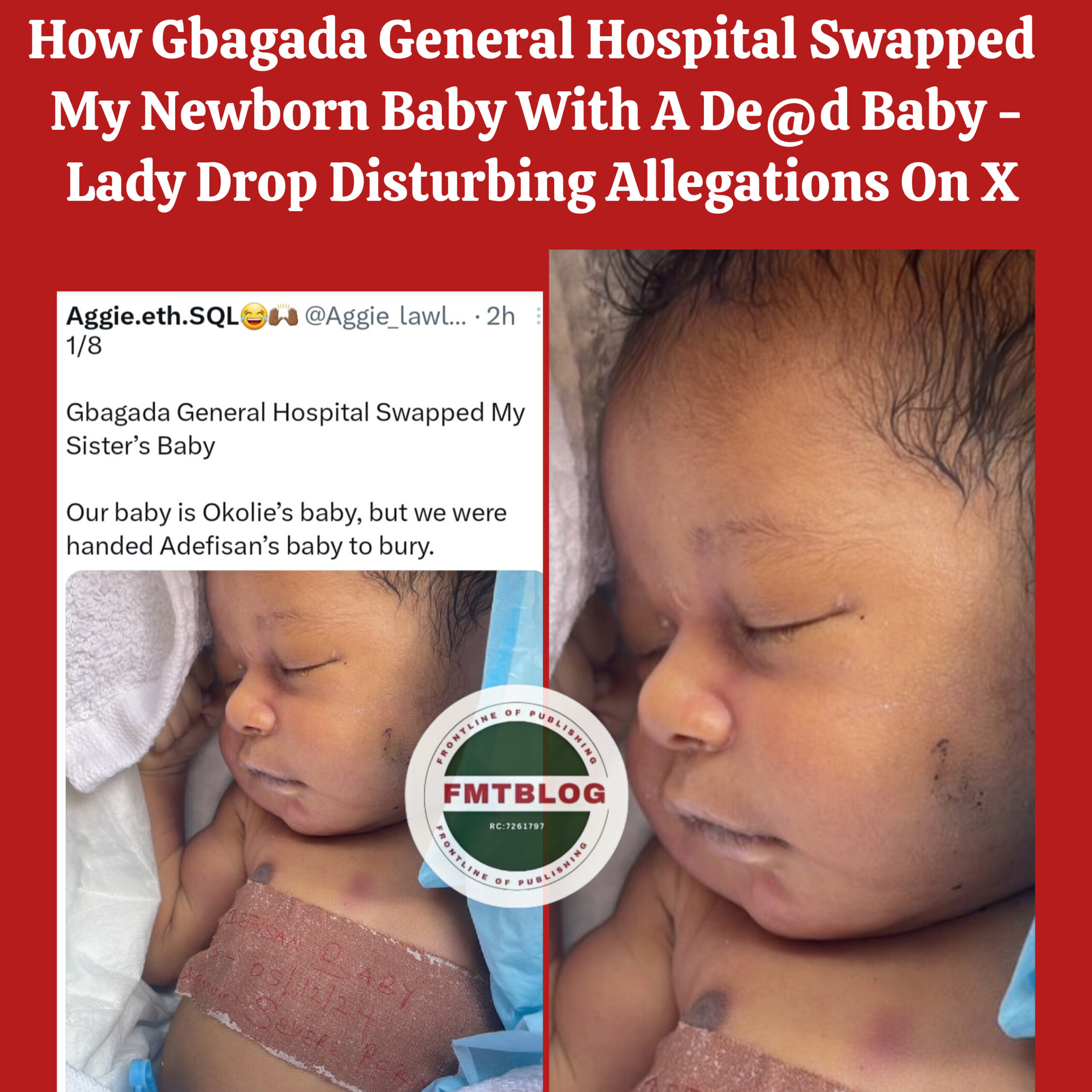 How Gbagada General Hospital Swapped My Newborn Baby With A De@d Baby – Lady Drop Disturbing Allegations On X