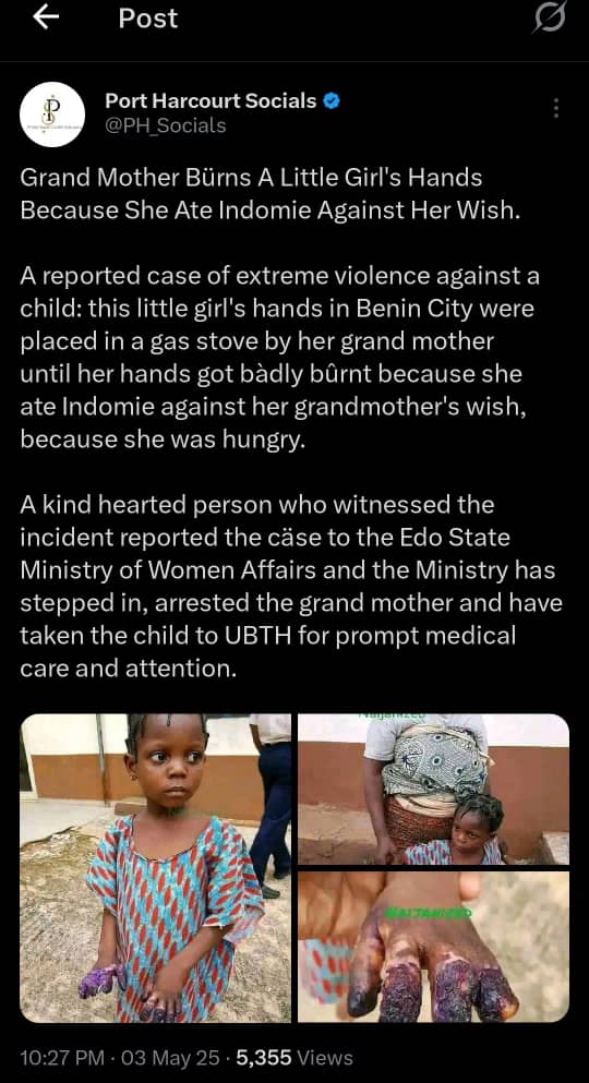 Grandmother Arrested in Benin City for Burning Granddaughter’s Hands Over Indomie