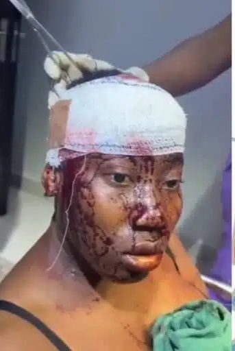 Woman Stabbed in the Head by Fiancé During Fight in Port Harcourt