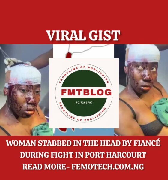Woman Stabbed in the Head by Fiancé During Fight in Port Harcourt