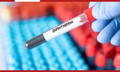 diphtheria outbreak