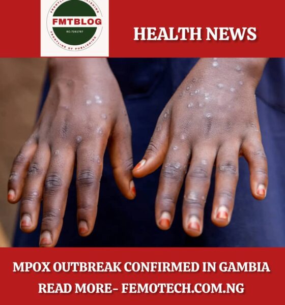 Mpox Outbreak
