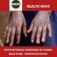 Mpox Outbreak
